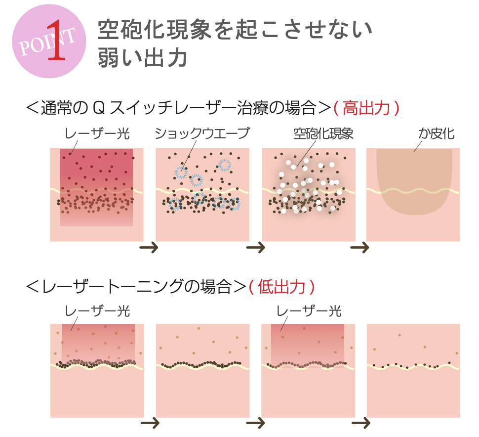 POINT1 空砲化現象を起こさない弱い出力