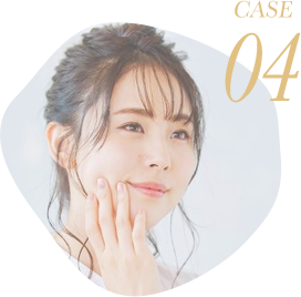 できるだけダウンタイムを抑えたい方