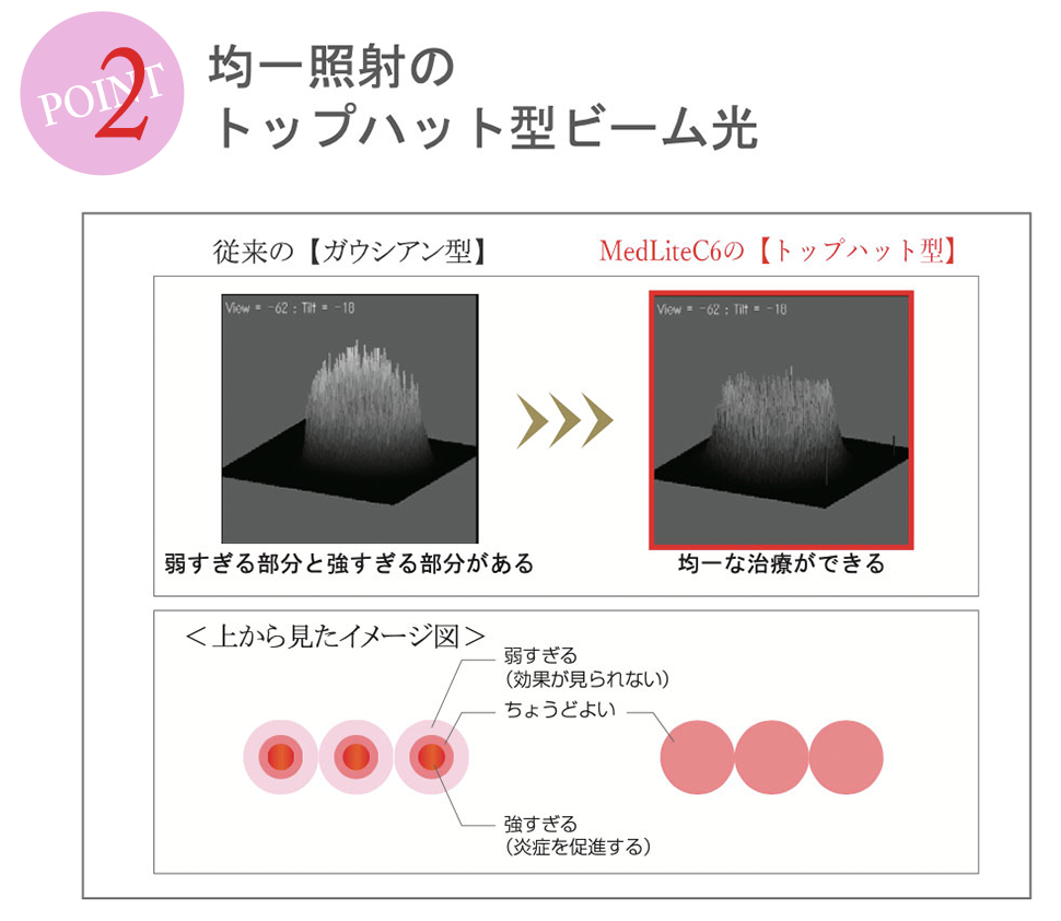 POINT2 均一照射のトップハット型ビーム光