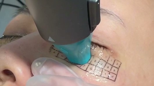 オリジオX アイ