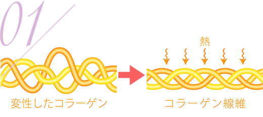 コラーゲン繊維が収縮することで高い引き締め効果&フェイスライン改善効果を発揮