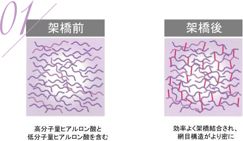 従来のヒアルロン酸注射よりも長期持続性を持っているため、効果が長持ちする